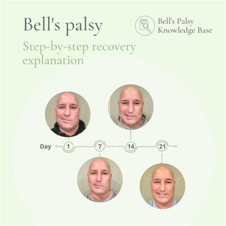 Andrew Dice Clay Shares Selfie Photo After Developing Bell’s Palsy – Hollywood Life
