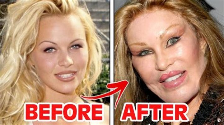 Heidi Montag Admits She ‘Sometimes’ Regrets Getting Plastic Surgery – Hollywood Life