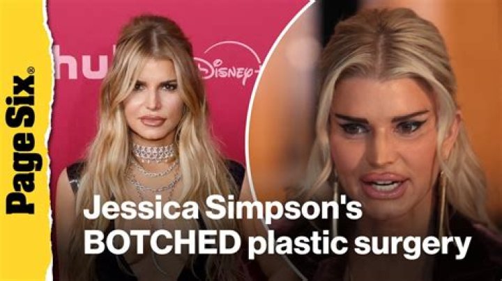 Non Surgical Facelift Jessica Simpson Tried – Hollywood Life