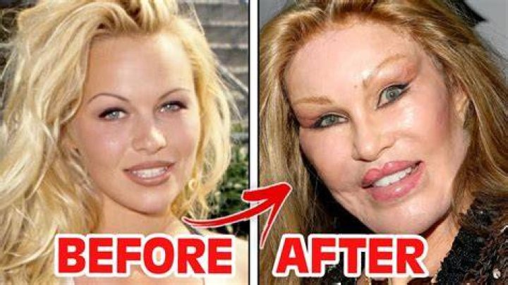Not Plastic Surgery – Hollywood Life