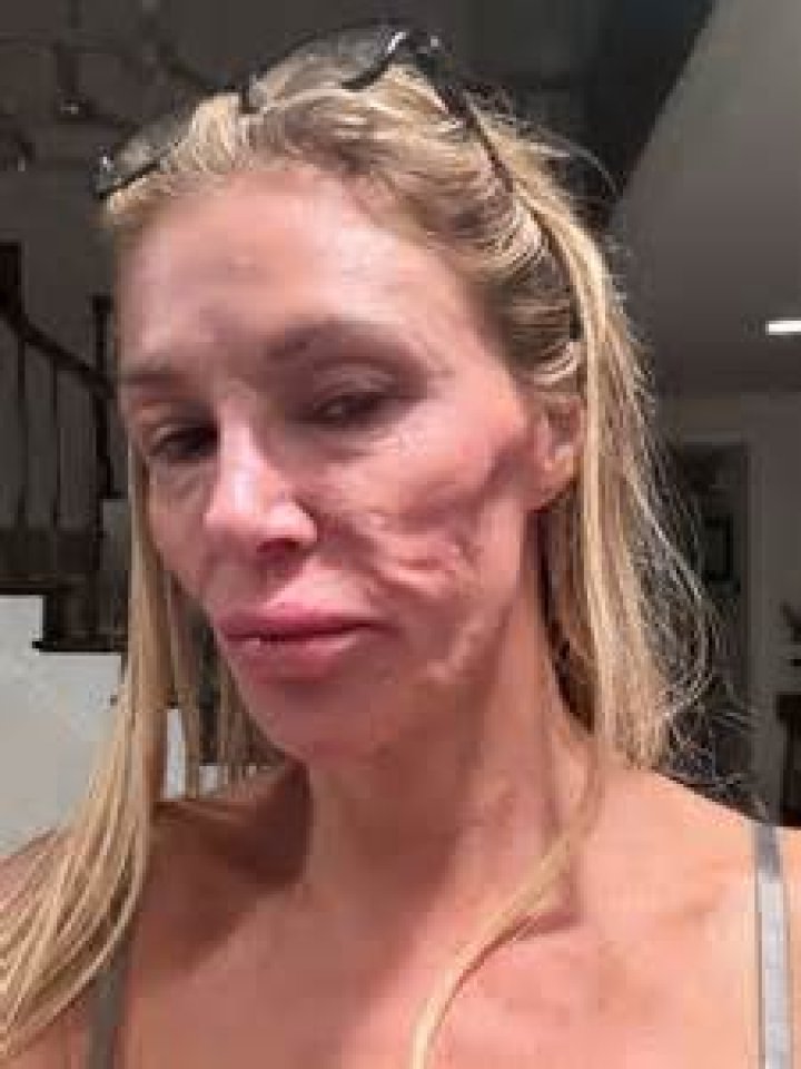 ‘RHOBH’ Alum Eileen Davidson Talks Denise Richards & Brandi Glanville’s ‘Ugly’ Drama