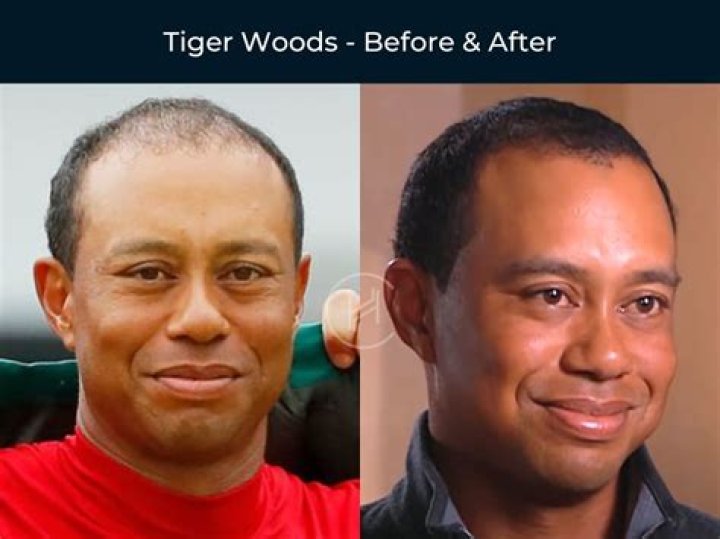 Tiger Woods In Surgery After Terrifying Car Crash: He Was ‘Extracted’ With An ‘Axe’