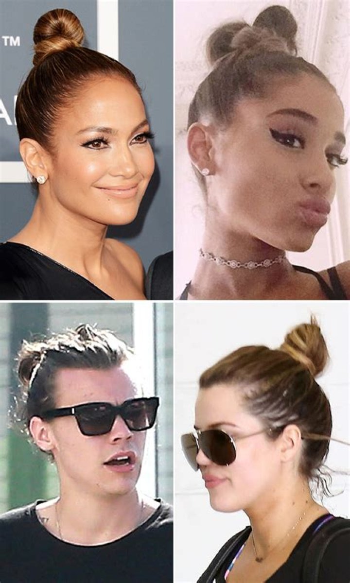 Traction Alopecia — Top Knot Bun Causing A Bald Head? Get A New Hairstyle – Hollywood Life