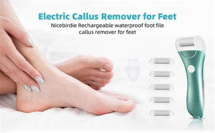 Treat Yourself To An At-Home Pedicure For Half The Price With This Electric Callus Remover For Under $25